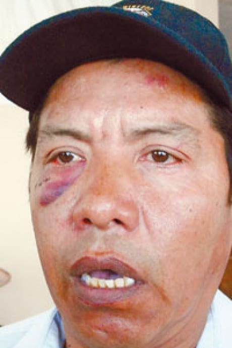 Mexican Mine Worker Union Activist Beaten